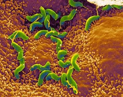 Trong 8 - 10 ngày tiếp theo, vi khuẩn ẩn náu bên trong cơ thể người xấu số như ở ruột sẽ phát triển và ăn các mô chết. Chính vì vậy, chúng đã giải phóng ra putrescine và cadaverine - những hợp chất làm cho cơ thể có mùi sau khi chết. Do đó, thi thể bắt đầu bốc ra mùi khó chịu.