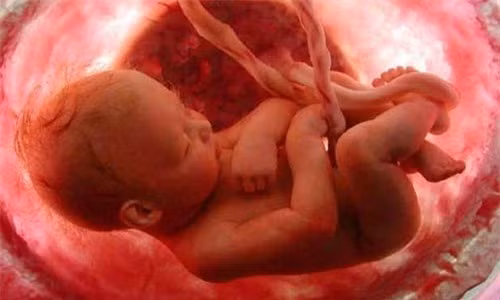 Một số bệnh lý khiến trẻ khó bú mẹ, ít nhất là trong giai đoạn đầu sau khi sinh (sứt môi hở hàm ếch, các bệnh lý thần kinh, tim mạch, hội chứng Down…được chẩn đoán trước sinh): Những trẻ này thường bú kém nên mẹ phải vắt sữa cho con; dự trữ sữa non trước sinh bổ sung nguồn cung cấp sữa nếu cần và giúp mẹ tập dượt vắt sữa trước khi bé chào đời.