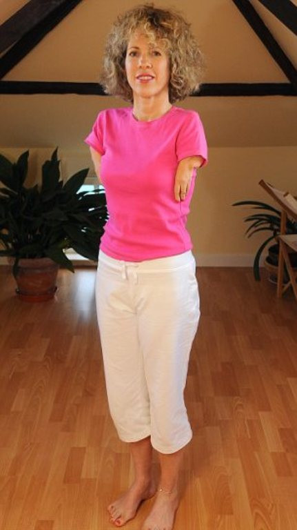 Sue là một nạn nhân của chứng Thalidomide từ khi còn là thai nhi, do mẹ của cô đã uống quá nhiều loại thuốc khắc phục các chứng rối loạn và khó chịu trong thời kỳ mang thai như nôn vào buổi sáng, mất ngủ, ho và bệnh cúm…