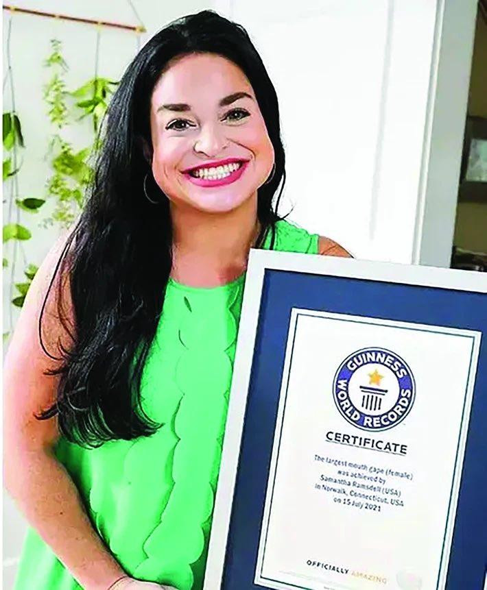 Người có khuôn miệng lớn nhất thế giới (6,52 cm): Sam Ramsdell từng rất tự ti về khuôn miệng có phần "quá khổ" của mình. Nhưng với sự khuyến khích từ bạn bè, cô gái người Mỹ này đã đứng lên chia sẻ câu chuyện của bản thân và đã có 2,6 triệu người theo dõi trên TikTok.