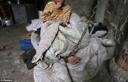 Khi ở nhà, Zili bị xích vào một chiếc cột. Khi ra ngoài, cha cậu bé cầm theo sợi xích và dắt cậu bé đi dạo theo con đường nhỏ quanh làng.