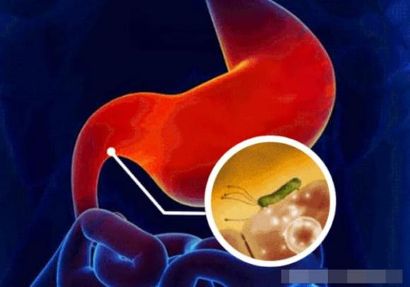 Canh giac voi 5 dau hieu tu benh da day den ung thu