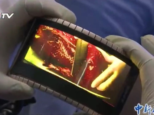 Có thể trong tương lai mẫu điện thoại này sẽ được ghi nhớ như một phần lịch sử của chiếc smartphone biến hình đầu tiên. Hoặc có thể không. Hãy để thời gian trả lời.