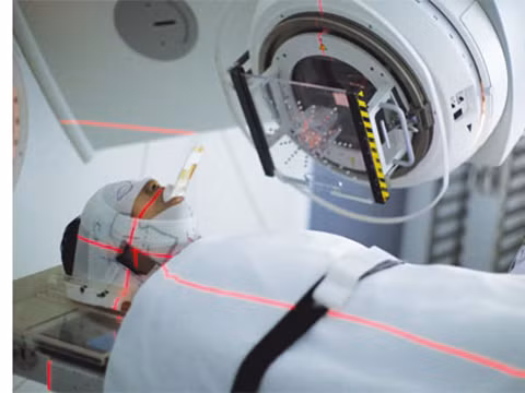 Kết hợp xạ trị - hóa trị đồng thời được xem là chọn lựa tối ưu và là bước đầu tiên điều trị ung thư cổ tử cung. Kết hợp xạ trị - hóa trị đồng thời được xem là chọn lựa tối ưu và là bước đầu tiên điều trị ung thư cổ tử cung.