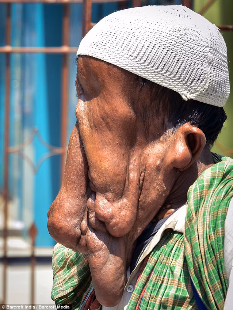 Tôi đã học cách tồn tại trong sự bần hàn. Cụ thể, tôi không sử dụng bàn chải đánh răng mà chỉ sử dụng các ngón tay của mình để vệ sinh răng miệng.