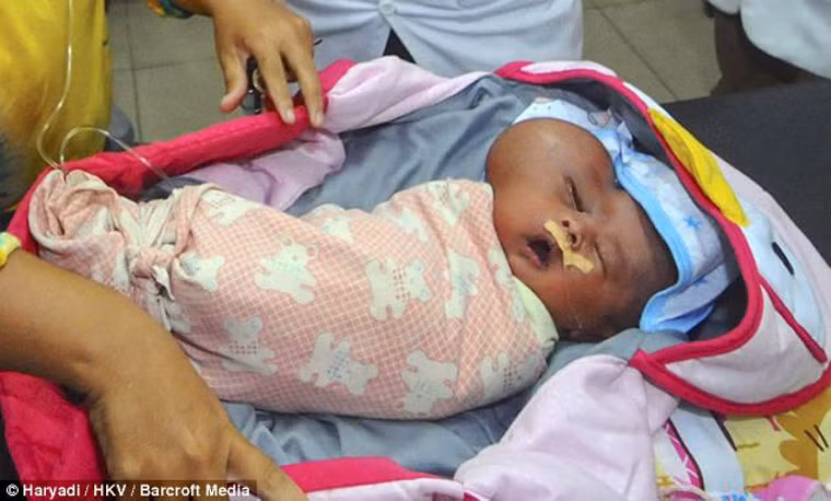 Lúc mới sinh, Muhammad nặng gần 3,2kg. Khối u xuất hiện ngay từ lúc em chào đời và đến nay đã ảnh hưởng đến chức năng của mắt phải. Các bác sĩ cho biết cần phải kiểm tra liệu khối u có ảnh hưởng đến các cơ quan khác hay không.