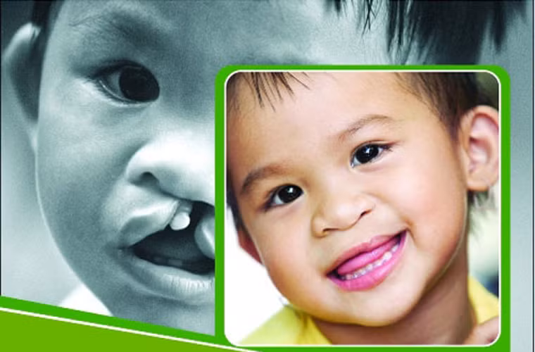 Tổ chức Operation Smile là một tổ chức phi lợi nhuận hoạt động trên lĩnh vực y tế, sức khỏe con người. Operation Smile thường thực hiện các ca phẫu thuật sứt môi, hở hàm ếch cho trẻ em ở các nước thu nhập trung bình và thấp.