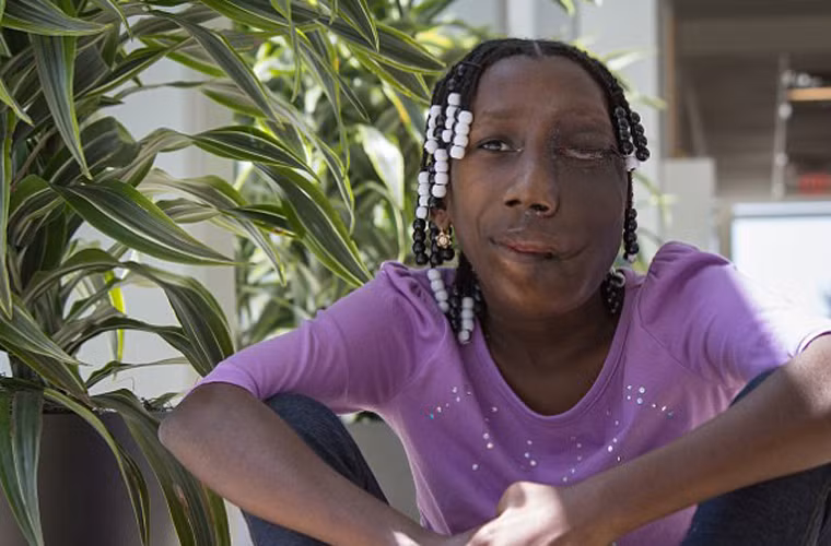 Khối u của Hennglise nặng khoảng 1,8kg và lệch hẳn sang một bên khiến gương mặt trở nên xấu xí. Cô bé cảm thấy tự ti và thường xuyên phải đối diện với những ánh nhìn thiếu thiện cảm từ bạn bè cùng trang lứa.