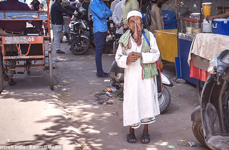Nói về hoàn cảnh của mình, Mannan chua chát tâm sự: “Ngay từ nhỏ tôi đã quen với cảnh nghèo túng và sự xa lánh của mọi người.