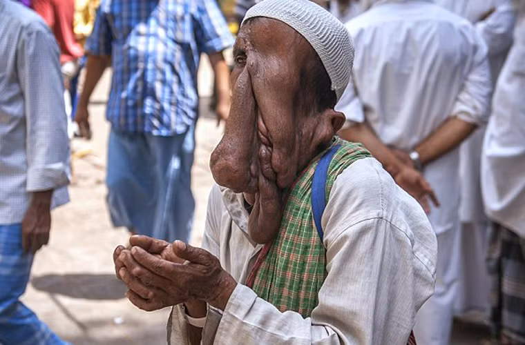 Hơn nữa, người con gái 20 tuổi của Mannan cũng sắp lấy chồng nên ông càng cần có tiền để chuẩn bị lễ cưới.