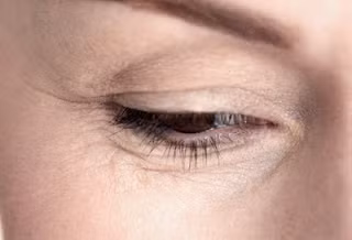 2. Nếu phía đuôi mắt càng hõm hoặc chằng chịt nếp nhăn thì đường tình duyên cũng "ba chìm bảy nổi", không phân biệt nam nữ.