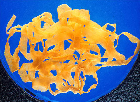 Sâu ăn não. Năm 2008, một phụ nữ ở Phoenix có tên Rosemary Alvarez, cho rằng bà sẽ có một cuộc phẫu thuật để bỏ u trong não. Nhưng khi bác sỹ tiến hành ca phẫu thuật, thay vì u não, họ phát hiện ra một con sâu sống ký sinh. Con sâu này đang ăn dần não của bà. Có thể bà đã ăn phải phân của một người, có chứa loài sâu này.