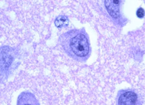 Amip ăn não. Loài amip này có tên là Naegleria fowleri. Loài này sống chủ ywwus ở những vùng nước ấm, sạch và đã giết chết vài người trong mấy năm qua. Nó lên được não thông qua đường mũi. Có 128 trường hợp được ghi nhận bị loài amip này tấn công, và có rất ít trong số này sống sót được.