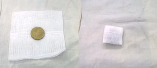 Nếu con bị rốn lồi, nên lấy đồng xu (loại 2.000 đồng), hoặc một miếng nhựa tròn có độ lớn tương tự, gói lại bằng băng gạc sạch, để lên lỗ rốn. Dùng băng thun rốn (có đàn hồi) quấn xung quanh bụng bé.