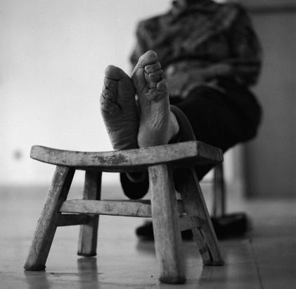 Họ cũng cho biết thêm hình thức làm đẹp này là văn hóa làm đẹp phù hợp theo từng thời kỳ, cũng giống như việc tiêm botox, nâng ngực hay trẻ hóa làn da.