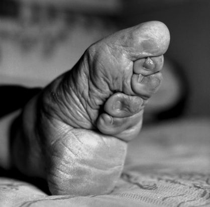 Bàn chân của họ sẽ được ngâm trong một hỗn hợp các loại thảo mộc và máu động vật để làm mềm cơ, các móng chân sẽ được cắt bỏ, sau đó bẻ quặp các ngón chân xuống và phía dưới và ép vào lòng bàn chân sao cho không còn khoảng cách giữa các ngón chân...