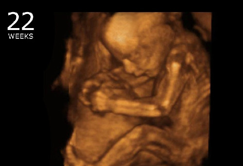 Thời gian này, nếu bạn cho rằng thai nhi không biết những hoạt động bên ngoài là hoàn toàn nhầm bởi bé có thể nghe thấy hết những gì bạn nói. Khi mang thai từ tuần 20-22 trở đi, mẹ hãy thường xuyên dành thời gian nói chuyện với thai nhi, hát hoặc kể chuyện hàng ngày cho con nghe. Cũng nên tận dụng thời gian bé có thể lắng nghe, cho bé nghe các bản nhạc cổ điển, những bản nhạc bạn yêu thích, để bé cảm nhận dần dần những âm thanh từ phía ngoài.