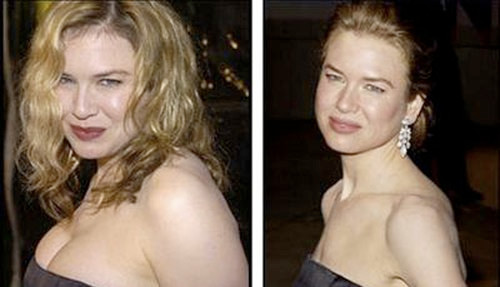 Nữ diễn viên Renee Zellweger là người đã giảm cân với phương pháp ăn uống đá lạnh này, cô đã giảm cân thành công kết hợp với việc tập luyện và đi bộ tới các cuộc họp báo trong 1 tháng.