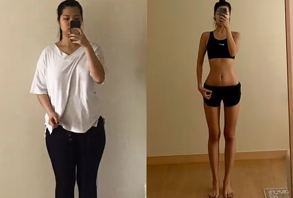 Điều này còn ảnh hưởng lớn đến sức khỏe của Seo YuJin, cô thường xuyên phải vào bệnh viện điều trị vấn đề xương khớp vì lượng cân lớn gây áp lực lên xương. 