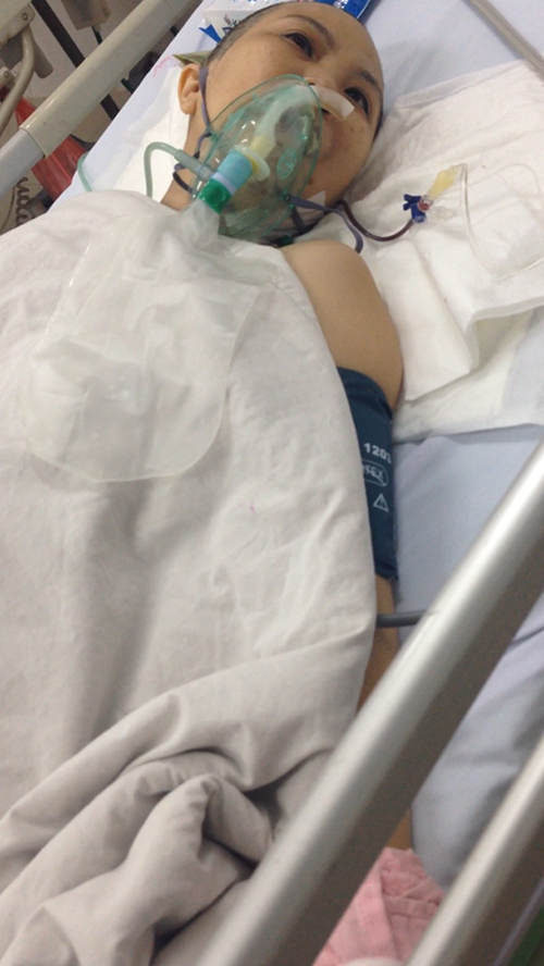 Benh nhan bi em ruot cat chan rat kho noi chi