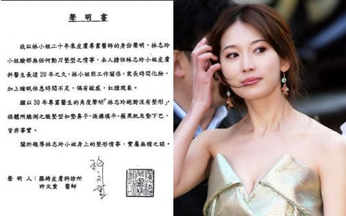 My nhan Hoa Ngu va muon van cach chung minh khong dao keo-Hinh-6