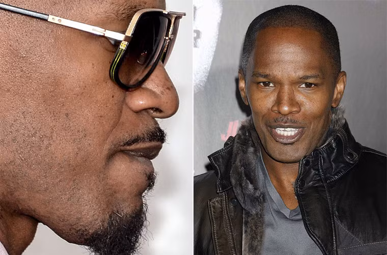 Khuôn mặt Jamie Foxx thật gớm ghiếc khi bị chụp sát mặt.