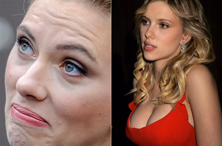 Tự hào về thân hình gợi cảm bao nhiêu thì Scarlett Johansson lại tự ti với khuôn mặt dễ nổi mụn của mình bấy nhiêu.