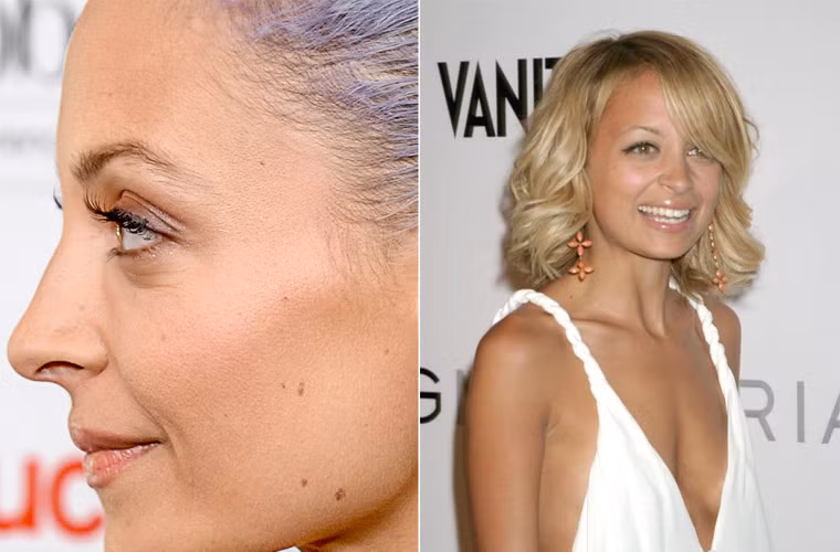 Ở tuổi 32 nhưng ngôi sao truyền hình thực tế Nicole Richie đã lộ những vết đồi mồi, dấu hiệu của tuổi già.