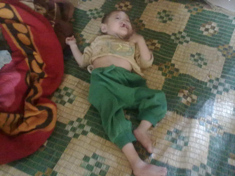 Đã hơn 4 tuổi nhưng bé Tâm chẳng khác gì một con mèo, da xanh xao vì không được ăn uống đầy đủ.