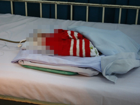 Cháu bé đang được điều trị tại BV nhi Quảng Nam.