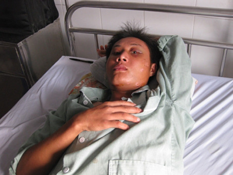 Nạn nhân Thưởng bị tổn hại tới 50% sức khỏe, nhưng Tuấn “Phương” và đàn em chưa bị xử lý về hành vi cố ý gây thương tích.