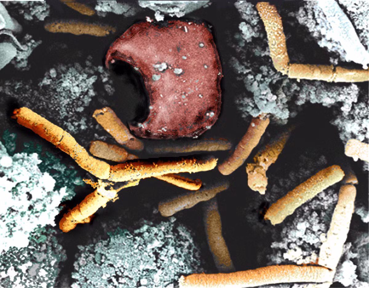 Loại khuẩn này có thời kỳ ủ bệnh tương đối ngắn, thường từ 1-5 ngày. Giống như các bệnh truyền nhiễm khác, thời kỳ ủ bệnh của bệnh Than khá âm thầm, khó nhận biết.