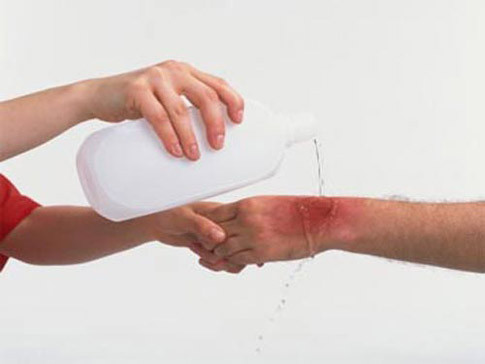 Nếu không may dính phải chất độc, bạn tuyệt đối không nên gãi hay chà vào vùng da bị tổn thương mà hãy rửa sạch một cách nhanh nhất sau đó bôi thuốc và dùng thuốc theo chỉ dẫn của bác sĩ. Nếu xuất hiện tình trạng bội nhiễm, hoại tử cần đi khám tại các cơ sở y tế chuyên khoa về da liễu.