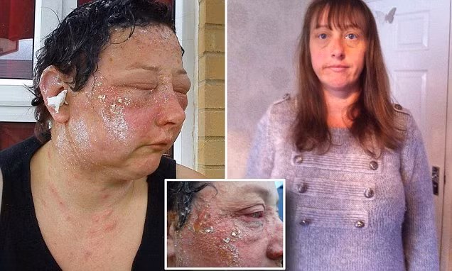 Tháng 8/2011, cô Jo Thomson, 39 tuổi đã tự nhuộm tóc tại nhà với thuốc nhuộm tên là"Cosmic Blue".