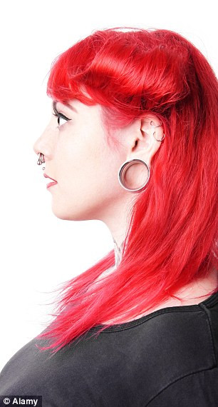 Bác sĩ Richards, Giám đốc Phòng khám lâm sàng tại Aurora, cũng là người tiên phong trong phương pháp thu gọn lỗ tai này phải điều trị khoảng 10 khách hàng/tháng.