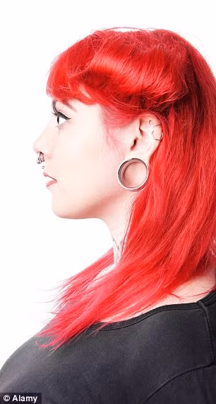 Bác sĩ Richards, Giám đốc Phòng khám lâm sàng tại Aurora, cũng là người tiên phong trong phương pháp thu gọn lỗ tai này phải điều trị khoảng 10 khách hàng/tháng.