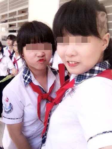 Hình ảnh nữ sinh 10x, học cấp hai và có mái tóc cạo rất hầm hố khiến người nhìn sửng sốt. Nữ sinh xuất hiện trong bức ảnh mặc đồng phục, đeo khăn quàng đỏ từng gây xôn xao trên nhiều trang mạng giải trí.