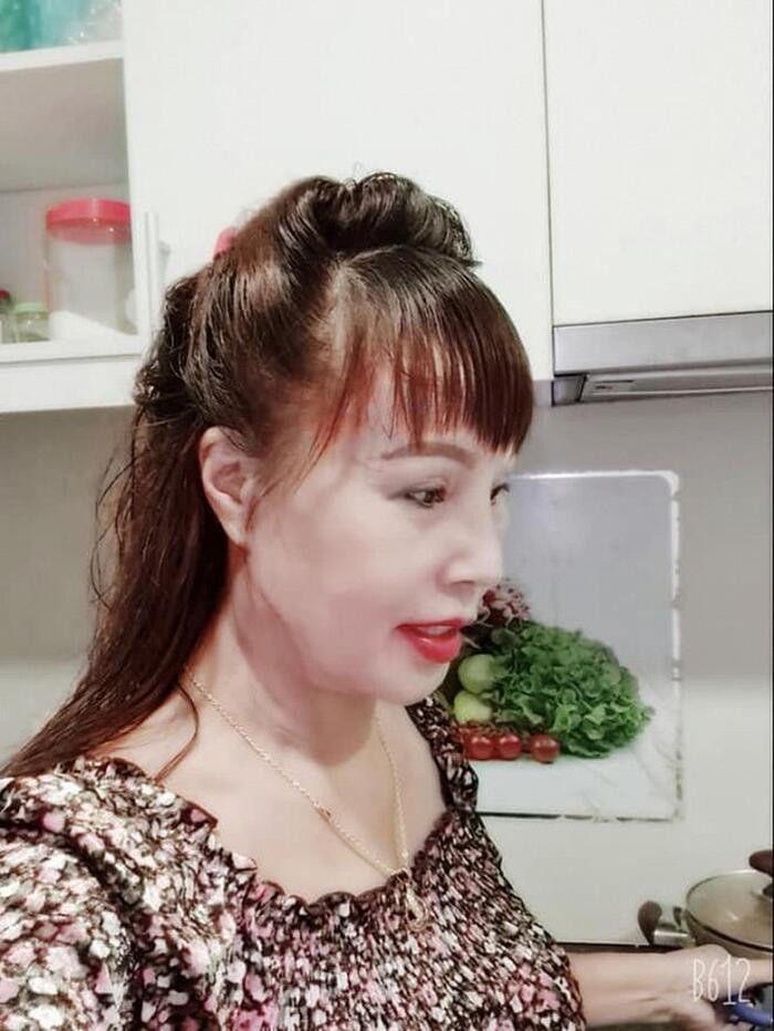 Co dau 62 tuoi chay vat ly tri lieu vi bien chung tham my-Hinh-4