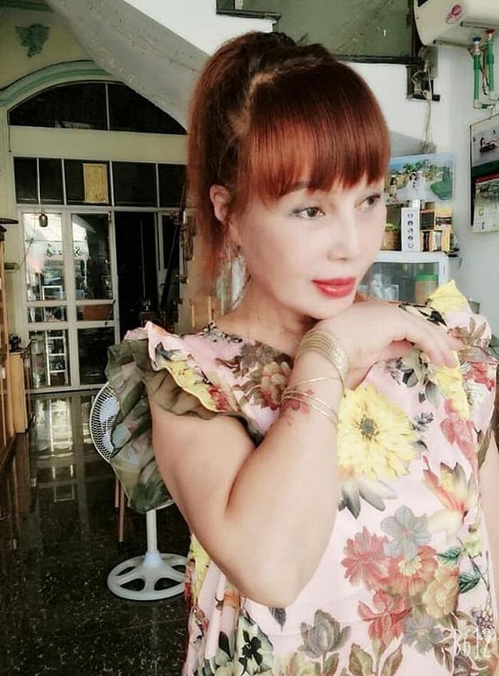 Co dau 62 tuoi chay vat ly tri lieu vi bien chung tham my-Hinh-3