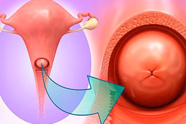 Luong kinh nguyet tang dot bien kiem tra ngay keo mac benh-Hinh-4