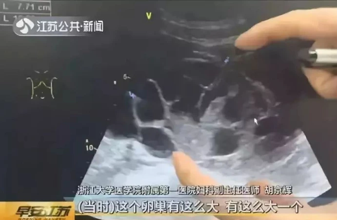 Nu sinh 20 tuoi lieu minh di 'hien' trung de mua iphone 12