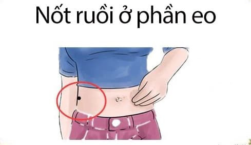 Dua tre co not ruoi o 3 vi tri nay la 