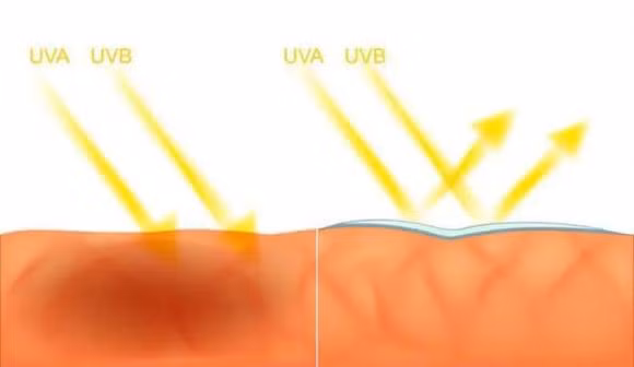 Not ruoi moc o 3 bo phan hay “lien quan mat thiet” den ung thu-Hinh-2