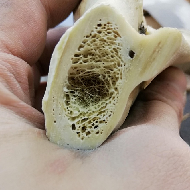 Đây là cấu trúc bên trong của xương.