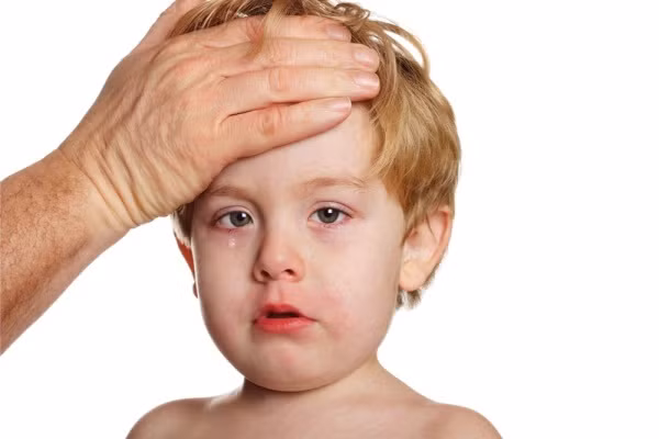 Quai bị. BIểu hiện quay bị của trẻ gồm: mệt mỏi, hơi sốt, có ho sau đó sưng và đau một bên mang tau rồi đau cả 2 bên. Thường trẻ sẽ tự khỏi trong khoảng từ 5 – 7 ngày. Quai bị là bệnh khá lành tính.