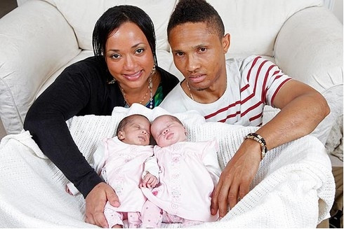 Bà bầu Pamela Frazer, người Anh, khiến các bác sĩ vô cùng kinh ngạc khi sinh đôi hai bé gái, trong đó một bé da trắng còn cô bé kia lại là da đen. Cặp song sinh khác màu da như thế này chỉ xảy ra với tỷ lệ một phần triệu. Rất nhiều người khi nhìn thấy hai bé không thể tin đây là cặp sinh đôi.