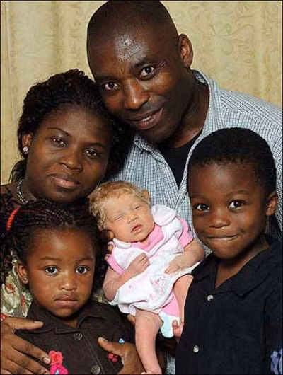 Cha mẹ da đen sinh con da trắng. Cặp vợ chồng da đen người Anh sống tại Woolwich, phía nam London đã khiến các chuyên gia trong lĩnh vực di truyền hết sức kinh ngạc vì họ đã sinh ra một cô bé xinh xắn trắng như trứng gà bóc. Điều khiến các chuyên gia di truyền kinh ngạc là cả ở Ben và Angela đều xuất thân từ những gia đình da đen chứ không phải là con lai. Các chuyên gia cũng nhận định rằng, bé Nmachi hoàn toàn không phải bị chứng bạch tạng.