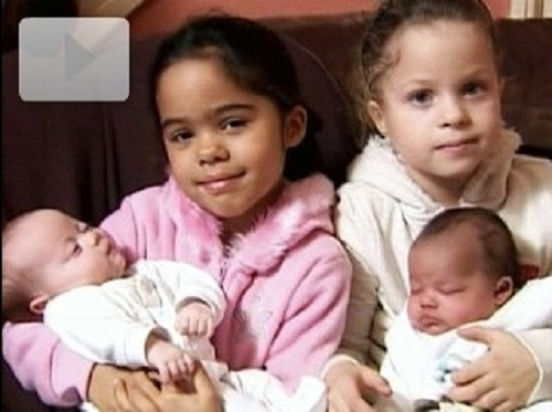 Hai lần đẻ con sinh đôi khác màu da. Một cặp vợ chồng khác chủng tộc ở Anh đã xóa nhòa sự khác biệt này hai lần bằng việc sinh ra hai cặp sinh đôi mà trong mỗi cặp đều có một em bé da đen và bé kia da trắng. Cô con gái mới sinh Miya của Dean Durrant có màu da sẫm giống như anh. Trong khi chị gái sinh đôi của bé - Leah - có màu da sáng với mái tóc đỏ và mắt xanh giống mẹ, Alison Spooner.