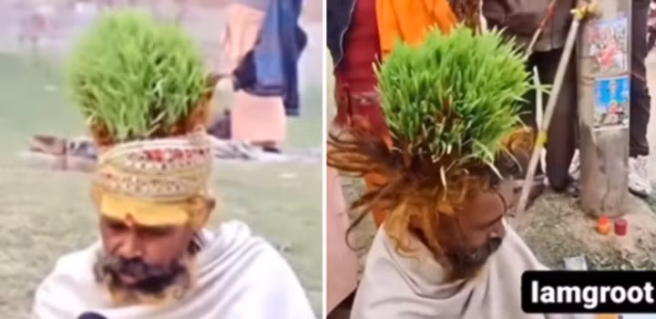 Người đàn ông trồng cỏ trên đầu, lấy tóc làm phân bón ảnh 1 Người đàn ông trồng cỏ trên đầu, lấy tóc làm phân bón ảnh 1