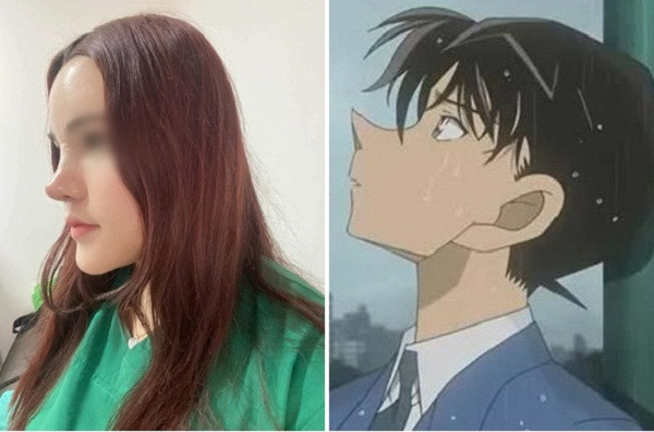 Pha nâng mũi "đi vào lòng đất", dân mạng gọi đó là "cầu trượt" ảnh 2